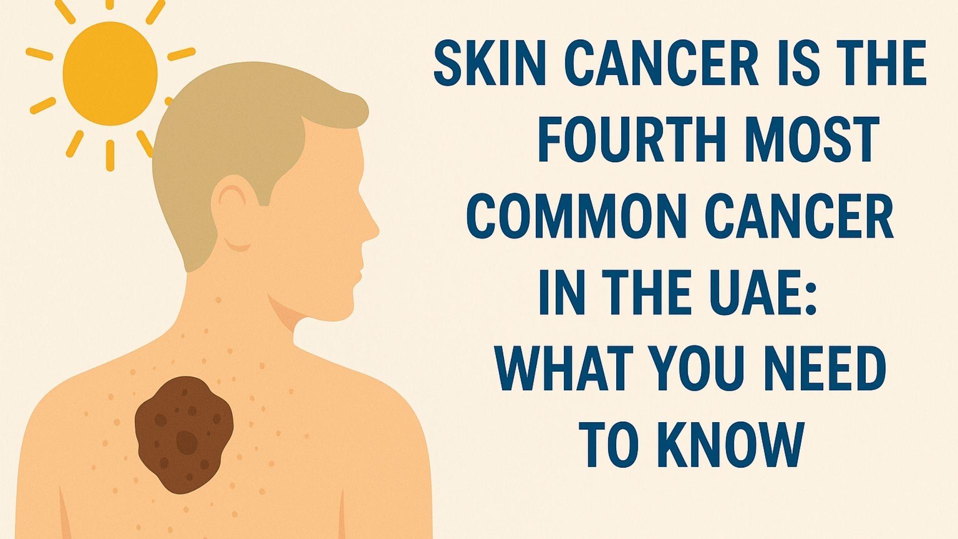 Skin Cancer in the UAE: Essential Facts and Prevention